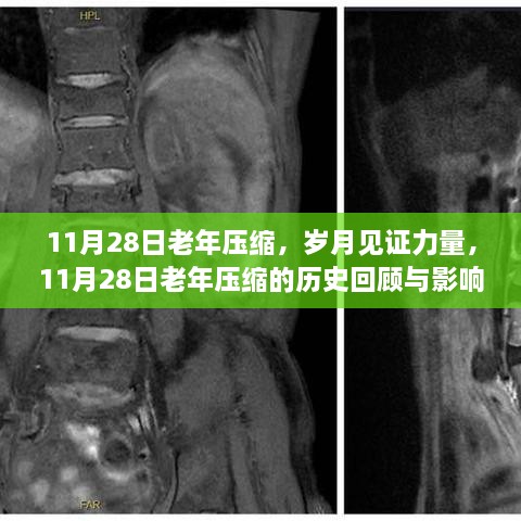 岁月见证力量，回顾与影响——11月28日老年压缩的历史