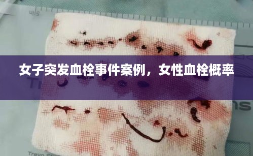 女子突发血栓事件案例，女性血栓概率 