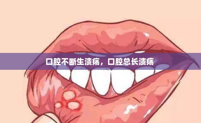 口腔不断生溃疡，口腔总长溃疡 