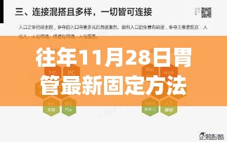 往年11月28日胃管最新固定方法专业解读与实操指南PPT重磅更新发布