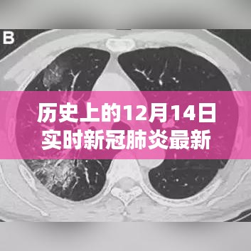 历史上的12月14日新冠肺炎实时情况回顾与多元观点探讨