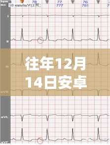 安卓开发实时心电图，温馨心电互动日常体验分享