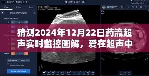 建议，爱在超声中传递，2024年药流超声实时监控的奇妙一日图解