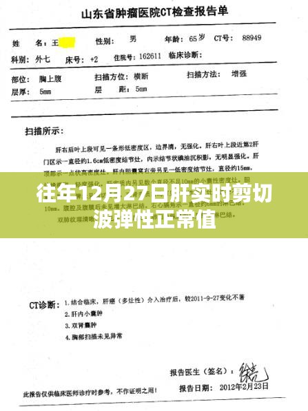 肝实时剪切波弹性正常值解析