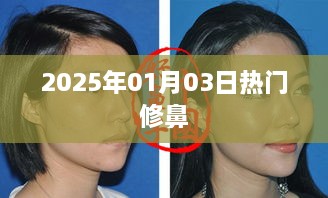 热门鼻修复术，掌握最新资讯，就在2025年1月3日